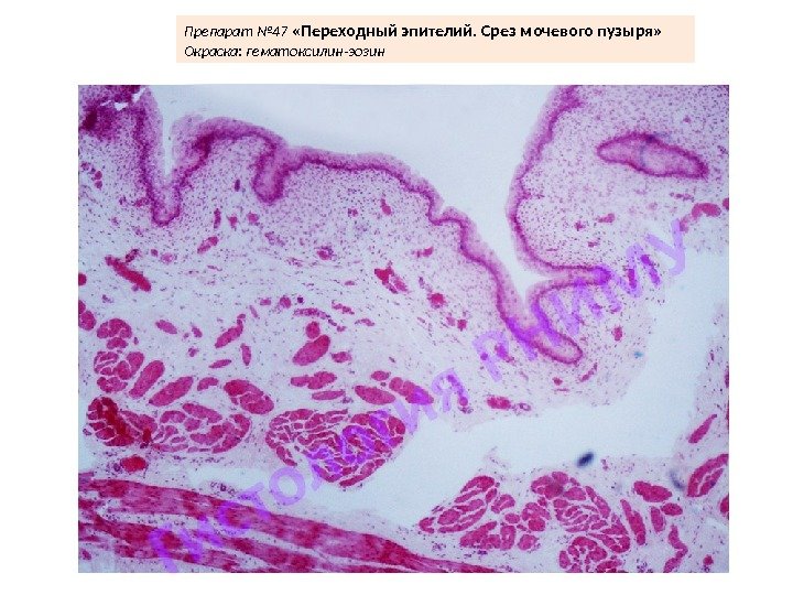 Препарат № 47  « Переходный эпителий. Срез мочевого пузыря» Окраска: гематоксилин-эозин  