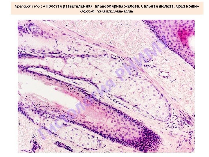 Препарат № 51  «Простая разветвленная альвеолярная железа. Сальная железа. Срез кожи» Окраска: гематоксилин-эозин