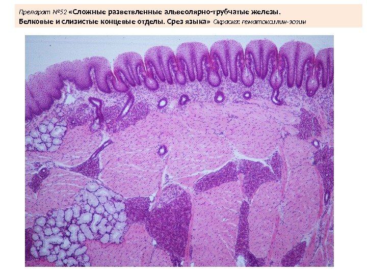 Препарат № 52  «Сложные разветвленные альвеолярно-трубчатые железы.  Белковые и слизистые концевые отделы.