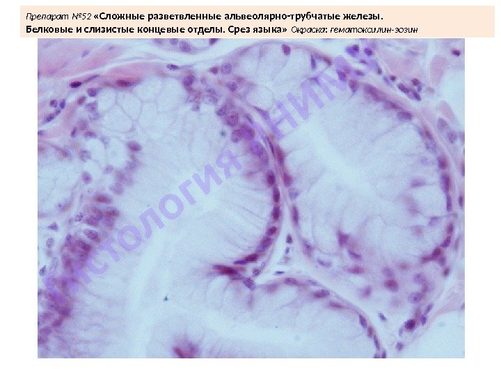 Препарат № 52  «Сложные разветвленные альвеолярно-трубчатые железы.  Белковые и слизистые концевые отделы.