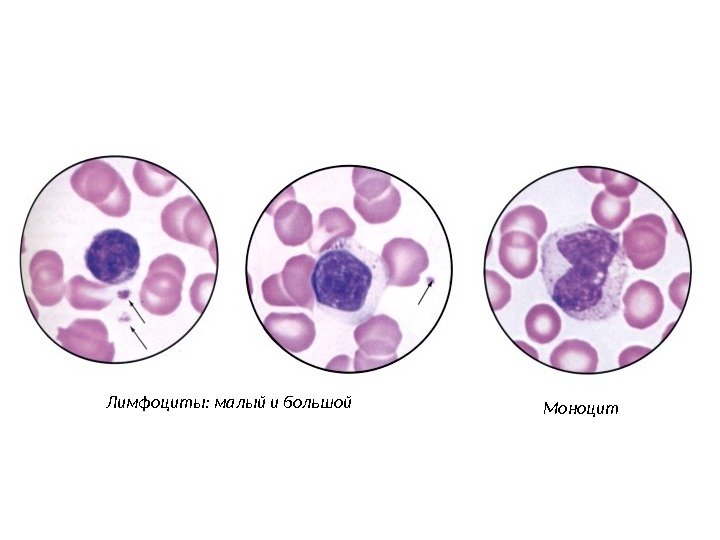 Лимфоциты: малый и большой Моноцит 