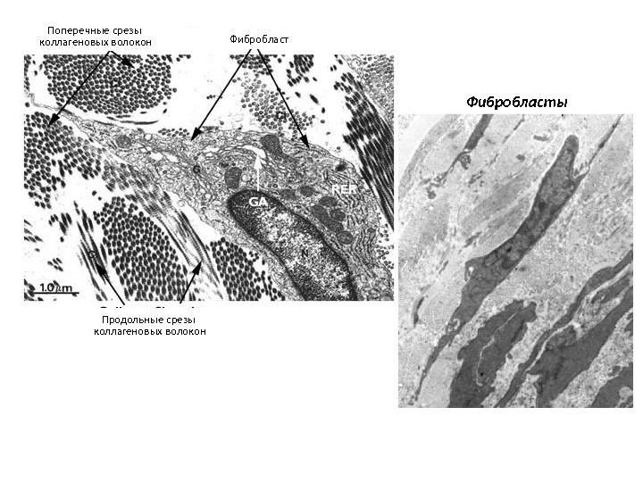 Поперечные срезы коллагеновых волокон Продольные срезы коллагеновых волокон Фибробласты 