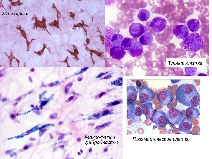 Макрофаги и фибробласты Тучные клетки Плазматические клетки 