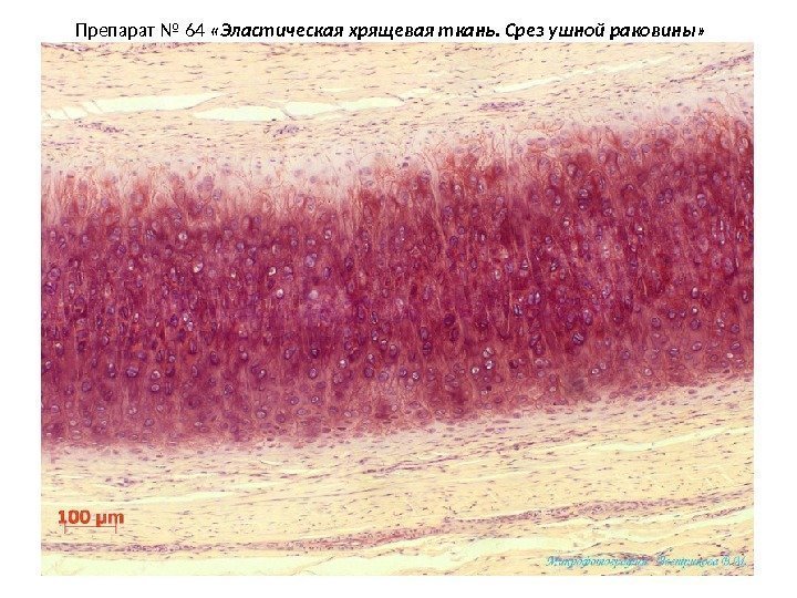 Препарат № 64  «Эластическая хрящевая ткань. Срез ушной раковины» 