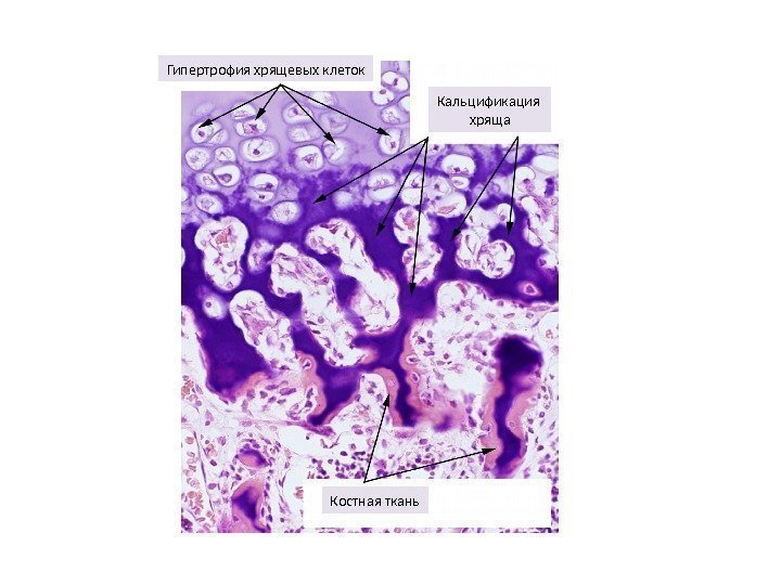 Гипертрофия хрящевых клеток Кальцификация хряща Костная ткань 