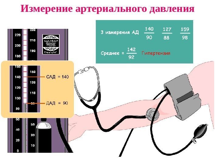 Измерение артериального давления 