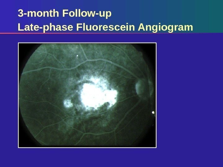 3 -month Follow-up Late-phase Fluorescein Angiogram 