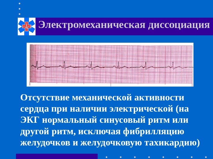 Электромеханическая диссоциация Отсутствие механической активности сердца при наличии электрической (на ЭКГ нормальный синусовый ритм
