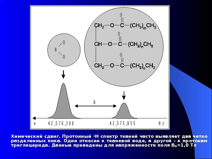 Химический сдвиг. Протонный 1 Н спектр тканей часто выявляет два четко разделенных пика. 