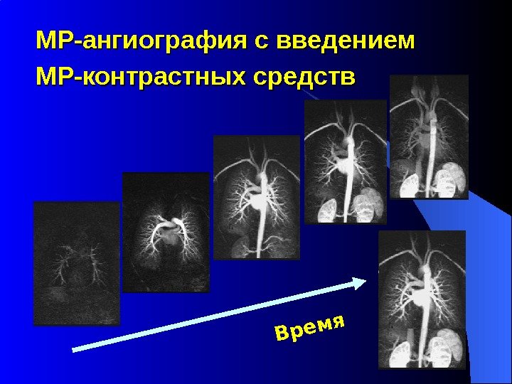 МР-ангиография с введением МР-контрастных средств  Время 