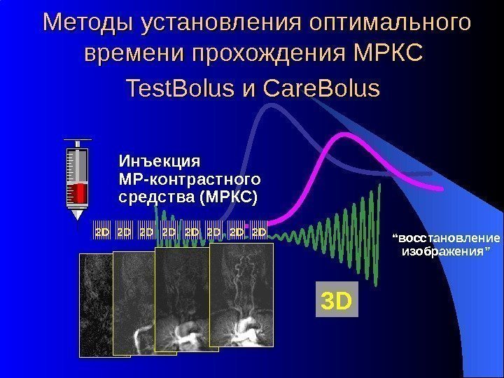 Методы установления оптимального времени прохождения МРКС Test. Bolus и и Care. Bolus  3
