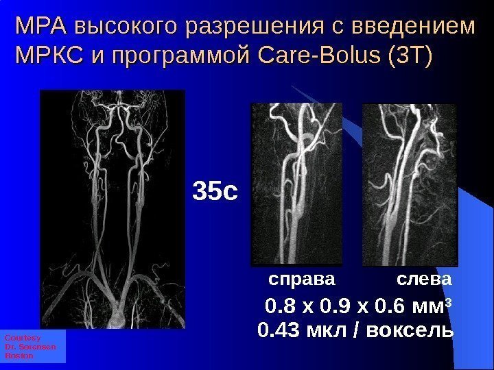  0. 8 x 0. 9 x 0. 6 мм 3 0. 43 мкл