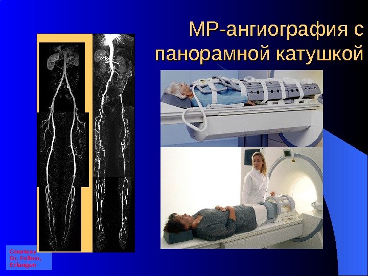 МР-ангиография с панорамной катушкой Courtesy Dr. Fellner,  Erlangen 