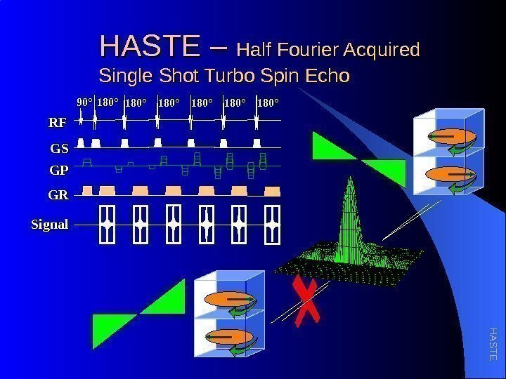 HASTE – Half Fourier Acquired Single Shot Turbo Spin Echo Signal GPGP GRGR GSGSRFRF