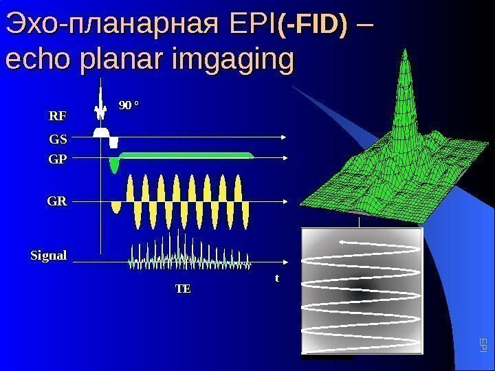 Эхо-планарная EPIEPI (-FID) – – echo planar imgaging GPGP GRGR Signal GSGS RFRF tt