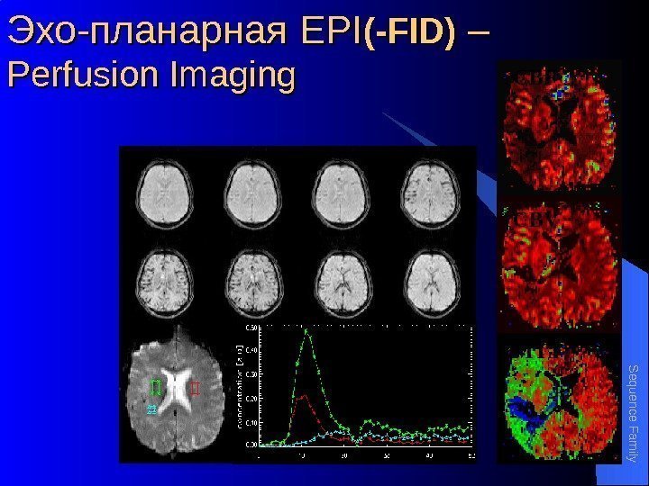 Эхо-планарная EPIEPI (-FID) – – Perfusion Imaging r. CBF r. CBV r. MTTSequence Fam