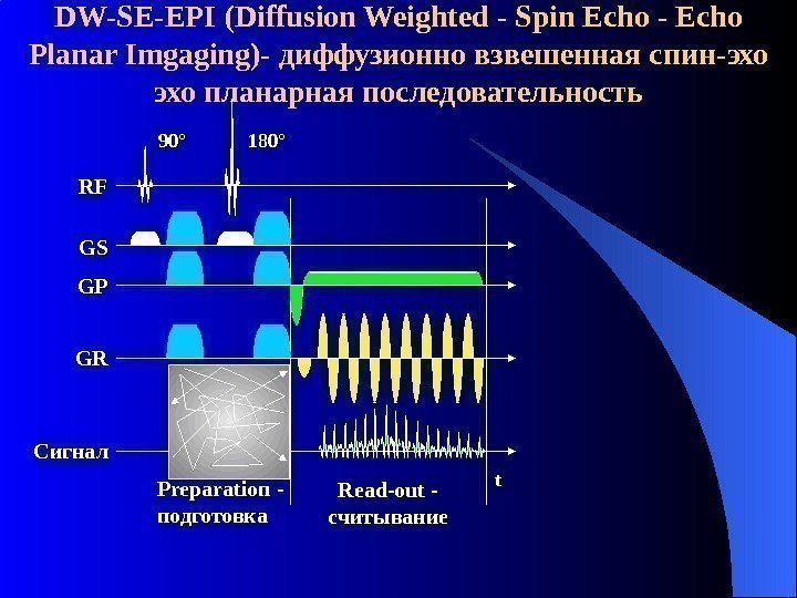DW-SE-EPI ( D iffusion Weighted - Spin Echo - Echo Planar Imgaging )- диффузионно