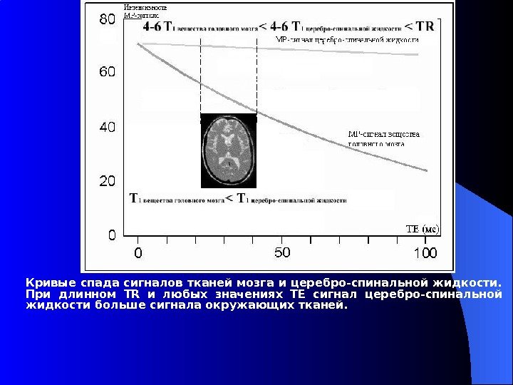 Кривые спада сигналов тканей мозга и церебро-спинальной жидкости.  При длинном TR и любых