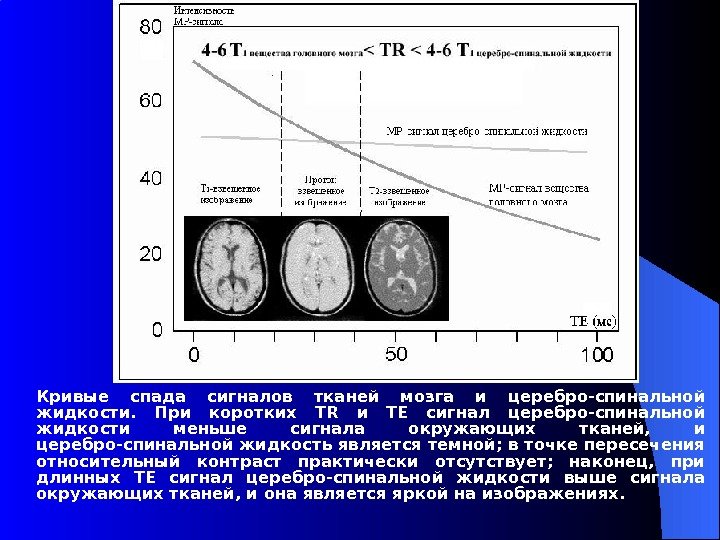 Кривые спада сигналов тканей мозга и церебро-спинальной жидкости.  При коротких TR и TE