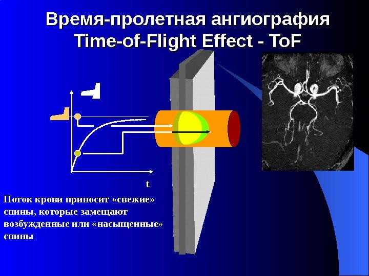 Время-пролетная ангиография Time-of-Flight Effect - To. Fz. M 0 M Поток крови приносит «свежие»