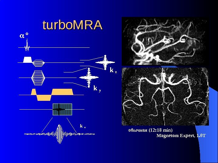 turbo. MRA Magnetom Expert, 1. 0 Tобычная (12: 18 min)k y k x k