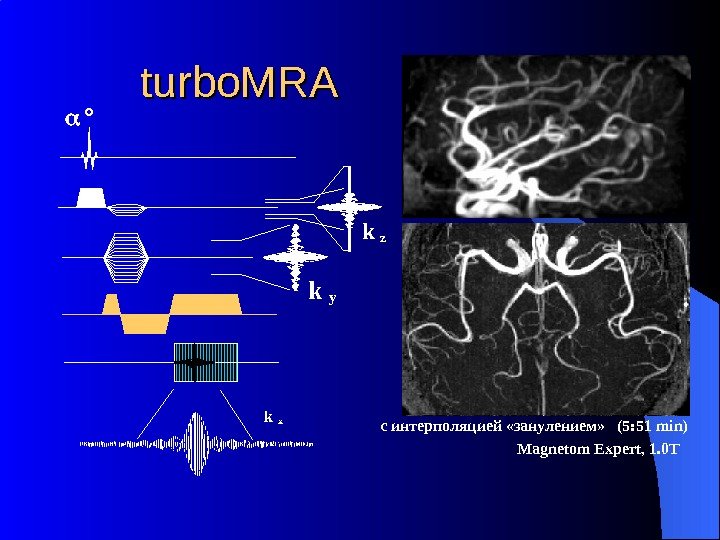 с интерполяцией «занулением» (5: 51 min)k yturbo. MRA ° k x k z Magnetom