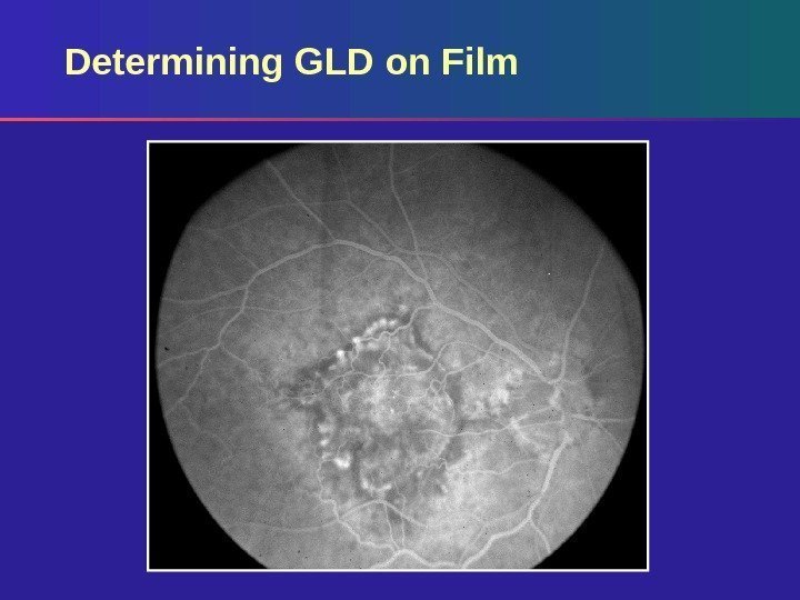 Determining GLD on Film 