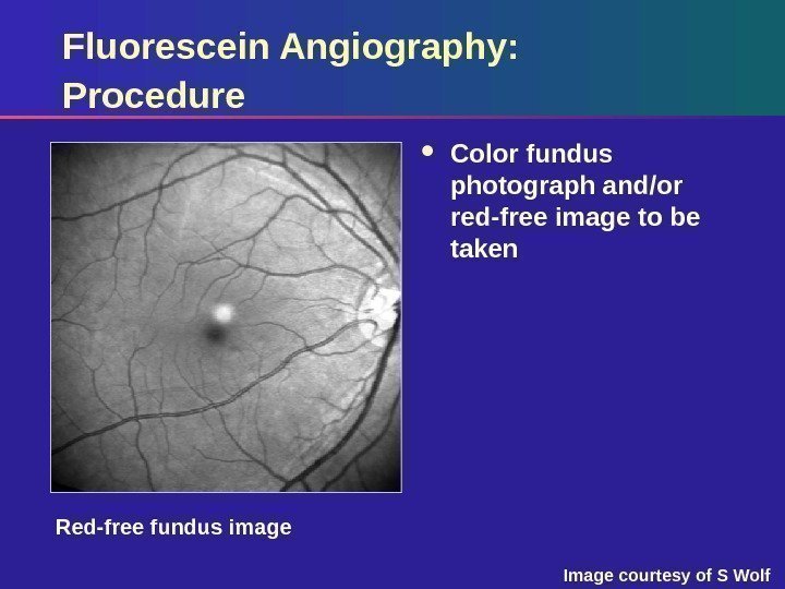 Red-free image. Fluorescein Angiography: Procedure Color fundus photograph and/or red-free image to be taken
