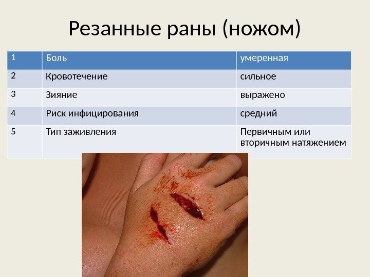 Резанные раны (ножом) 1 Боль умеренная 2 Кровотечение сильное 3 Зияние выражено 4 Риск