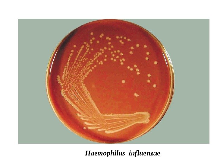 Haemophilus influenzae 