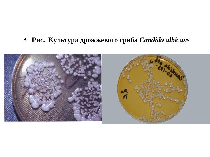  • Рис.  Культура дрожжевого гриба Candida albicans 