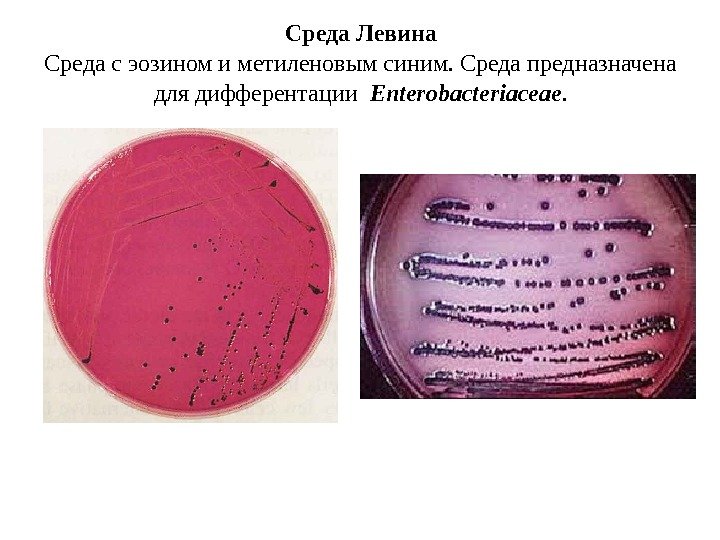 Среда Левина Среда с эозином и метиленовым синим. Среда предназначена для дифферентации  Enterobacteriaceae.