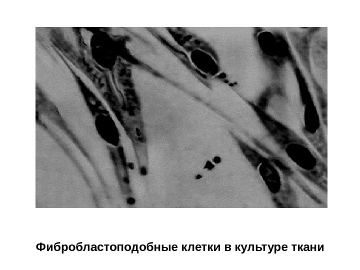 Фибробластоподобные клетки в культуре ткани 
