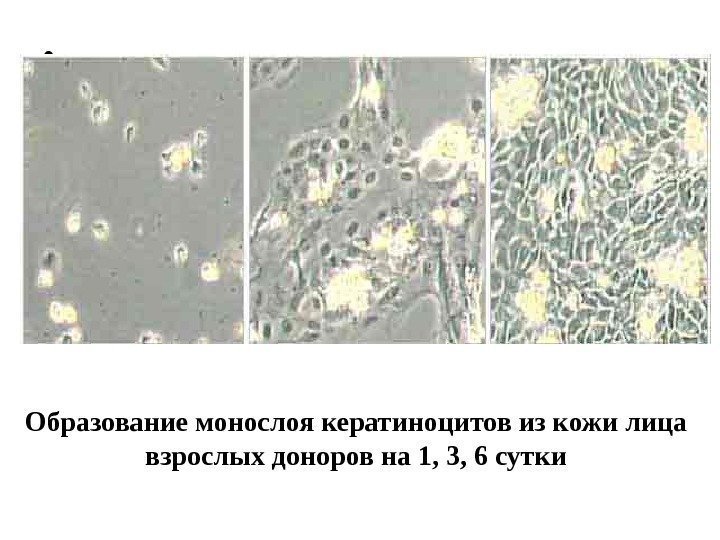  • Образование монослоя кератиноцитов из кожи лица взрослых доноров на 1, 3, 6