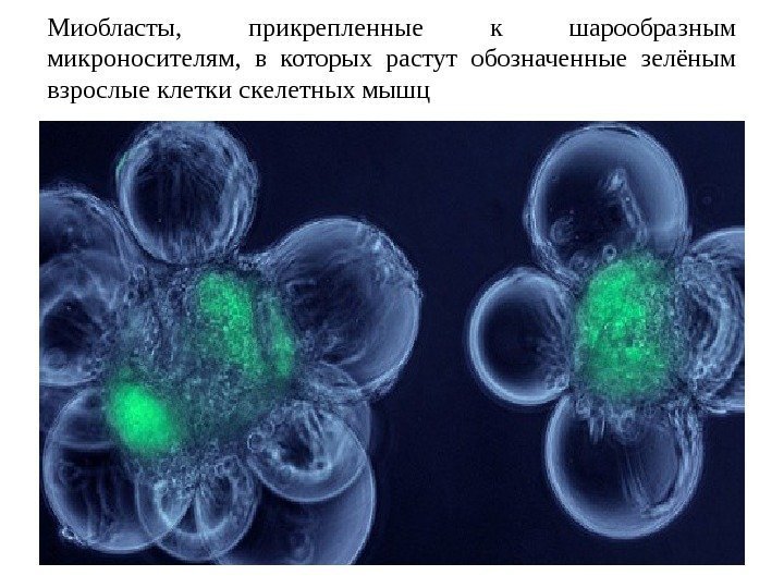 Миобласты,  прикрепленные к шарообразным микроносителям,  в которых растут обозначенные зелёным взрослые клетки