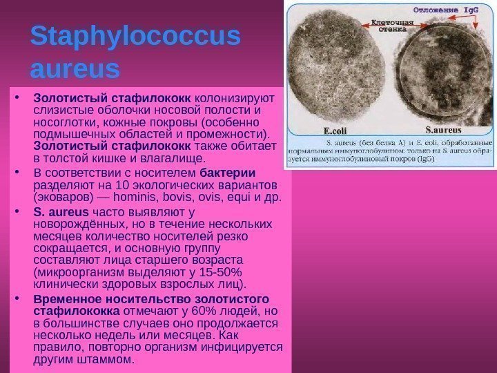   Staphylococcus aureus  • Золотистый стафилококк колонизируют слизистые оболочки носовой полости и