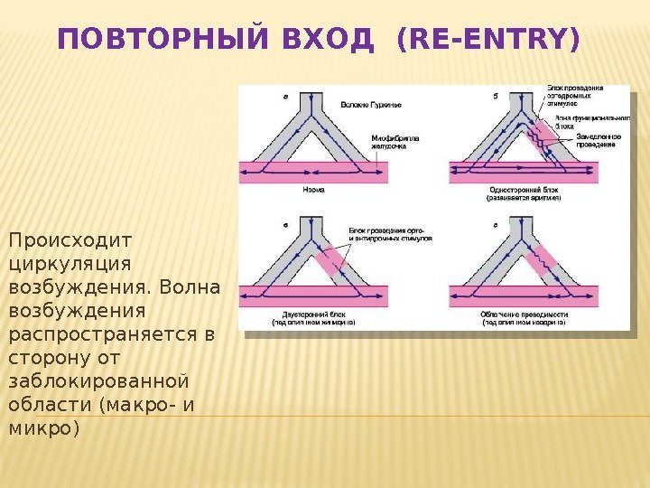 Исследование показавшее что антиаритмики 1с класса увеличивают смертность у больных после им