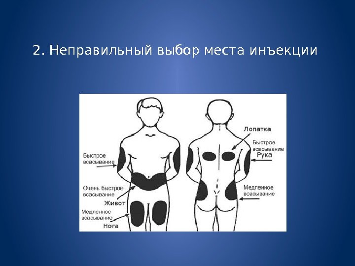 Осложнения после инъекций презентация с картинками