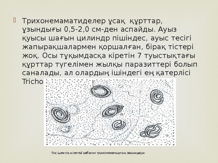  Трихонемаматиделер ұсақ құрттар,  ұзындығы 0, 5 -2, 0 см-ден аспайды. Ауыз қуысы