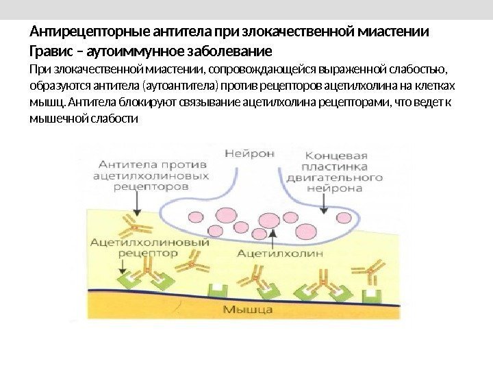Антирецепторные антитела при злокачественной миастении Гравис – аутоиммунное заболевание При злокачественной миастении, сопровождающейся выраженной