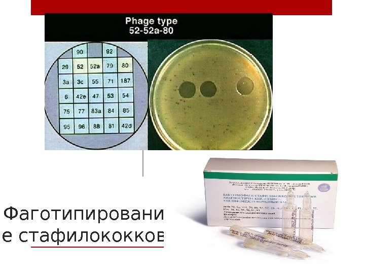 Фаготипировани е стафилококков 