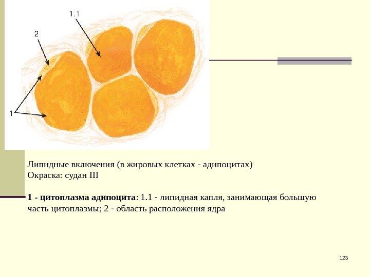 123 Липидные включения (в жировых клетках - адипоцитах) Окраска: судан III 1 - цитоплазма