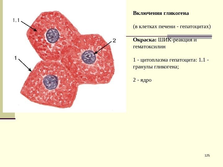 125 Включения гликогена (в клетках печени - гепатоцитах) Окраска:  ШИК-реакция и гематоксилин 1