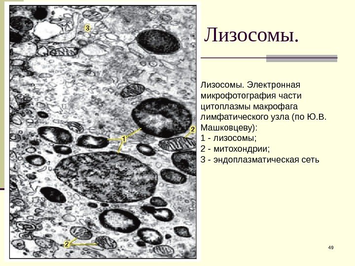 Лизосомы. 49 Лизосомы. Электронная микрофотография части цитоплазмы макрофага лимфатического узла (по Ю. В. 