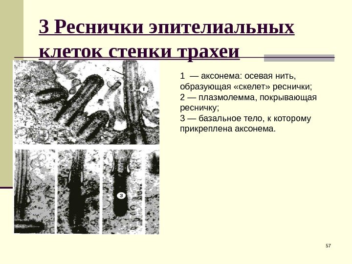 3 Реснички эпителиальных клеток стенки трахеи 571 — аксонема: осевая нить,  образующая «скелет»