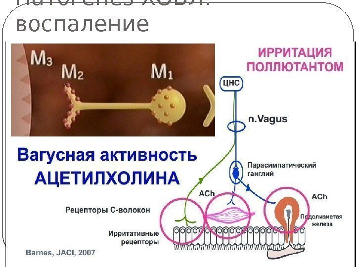 Патогенез ХОБЛ:  воспаление  