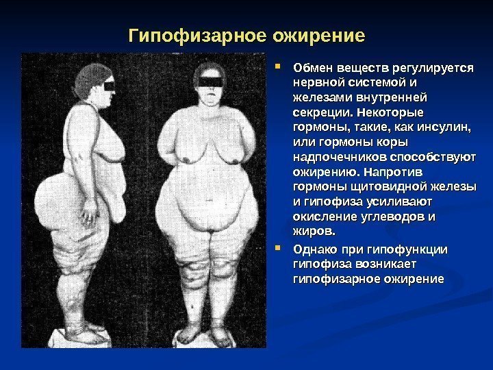 Гипофизарное ожирение Обмен веществ регулируется нервной системой и железами внутренней секреции. Некоторые гормоны, такие,