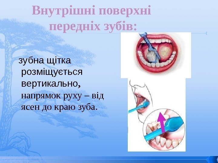   зубна щітка розміщується вертикально ,  напрямок руху – від ясен до