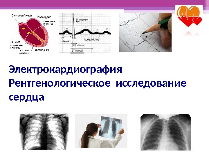 Электрокардиография Рентгенологическое исследование сердца   