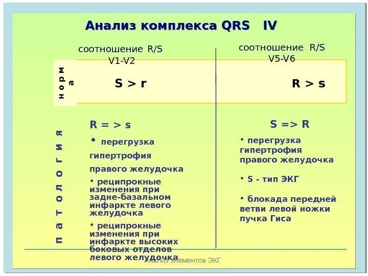   Анализ элементов ЭКГАнализ комплекса  QRS IV   S  r